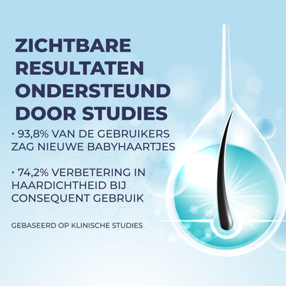 Minoxidil 5% Spray met 1% DHT Blocker & Castor Oil – Voor Sterker, Voller en Gezonder Haar