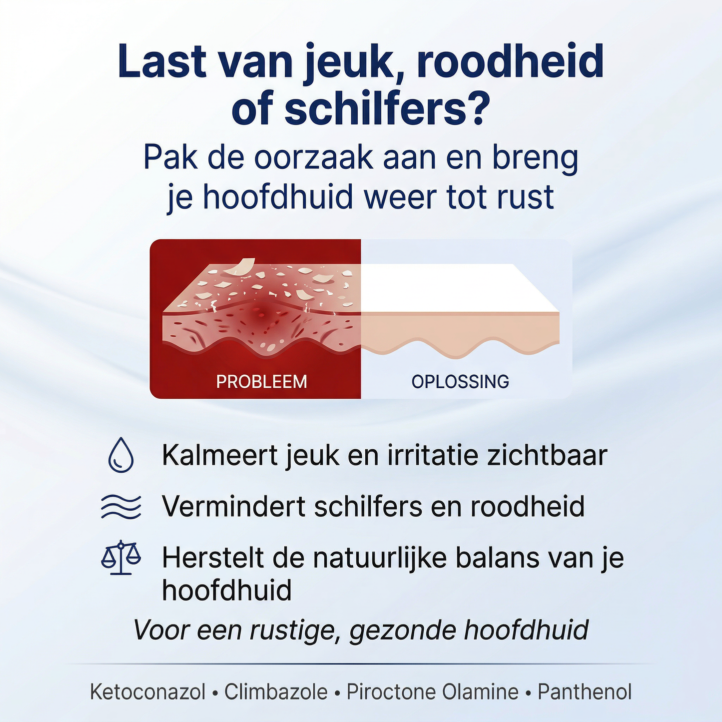 Ketoconazol Shampoo 2% | Tegen Roos - Jeuk, Seborrhoïsch Eczeem & Geïrriteerde Hoofdhuid -200 ML